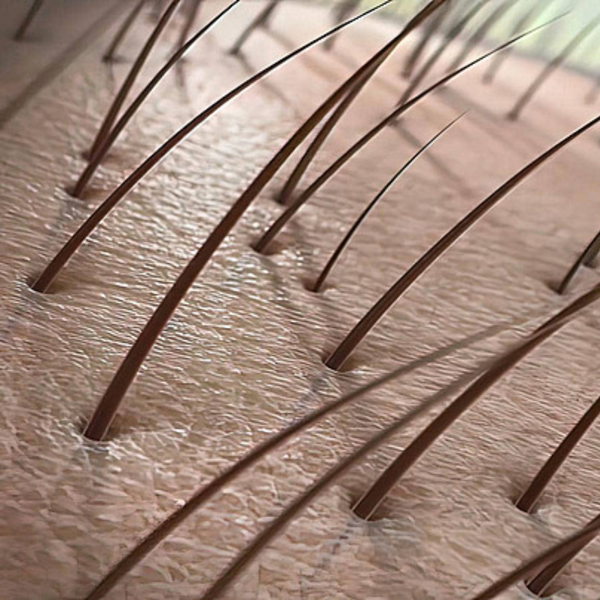 Support Scalp Wellness