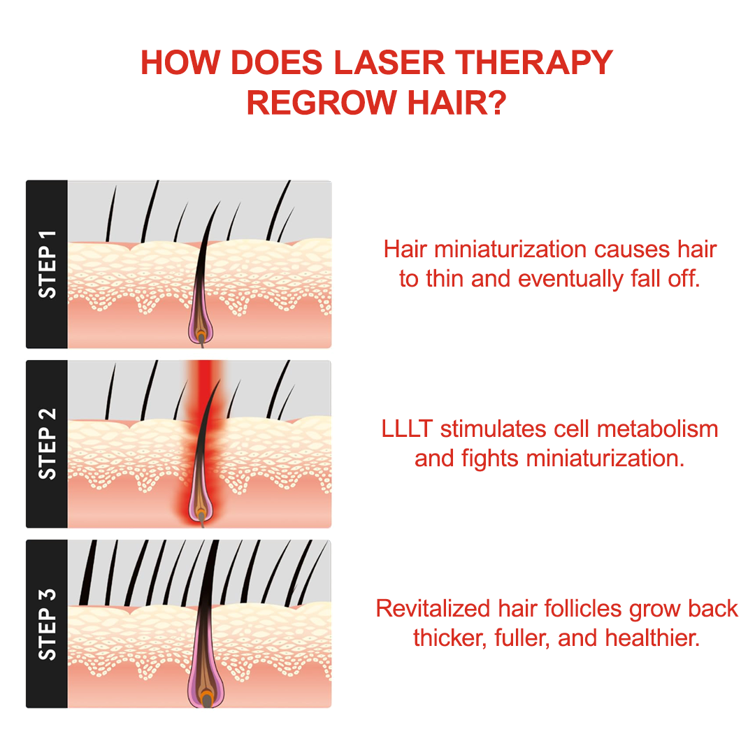 FAMGOES Plus 128 Laser Cap / Enhanced Scalp Coverage