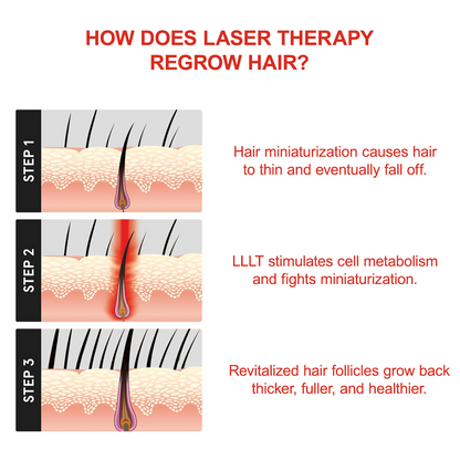 FAMGOES Plus 128 Laser Cap / Enhanced Scalp Coverage