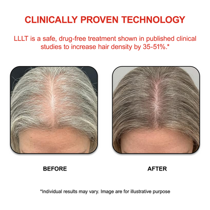 FAMGOES Plus 128 Laser Cap / Enhanced Scalp Coverage